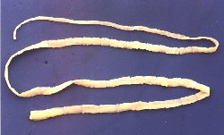 Tapeworm.jpg